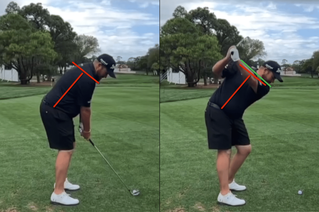 shane lowry shoulder tilt